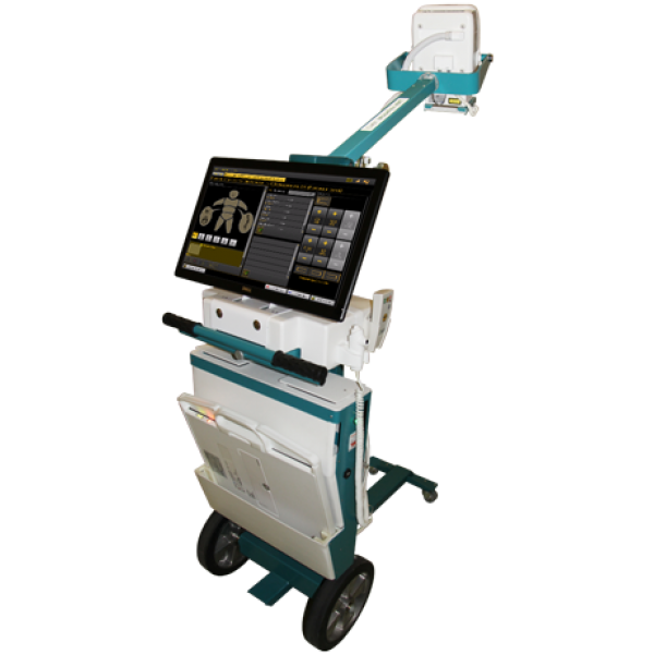 Мобильный рентгеновский аппарат серии «МобиРен-4МТ» (цифровой)