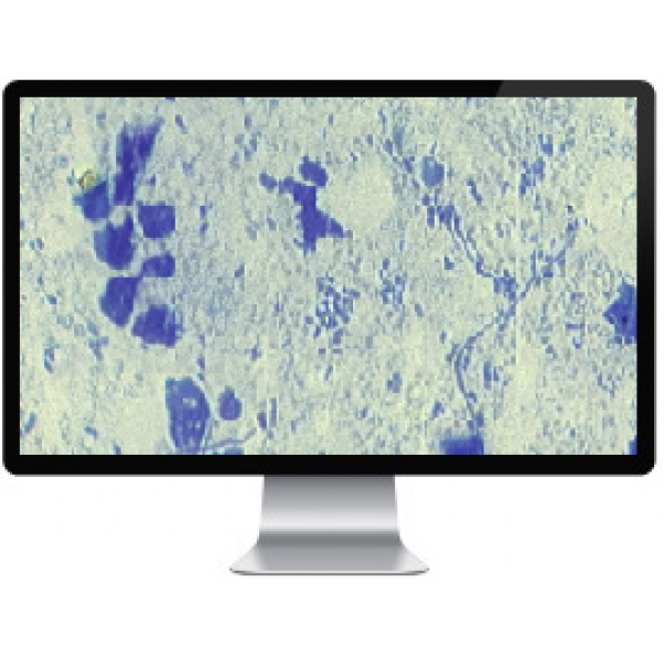 Сканер MECO-GYNECOL для анализов гинекологических мазков