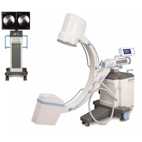 Мобильные рентгенохирургические аппараты типа С-дуга-“АРХМ-РЕНЕКС” 5 — 15 кВт